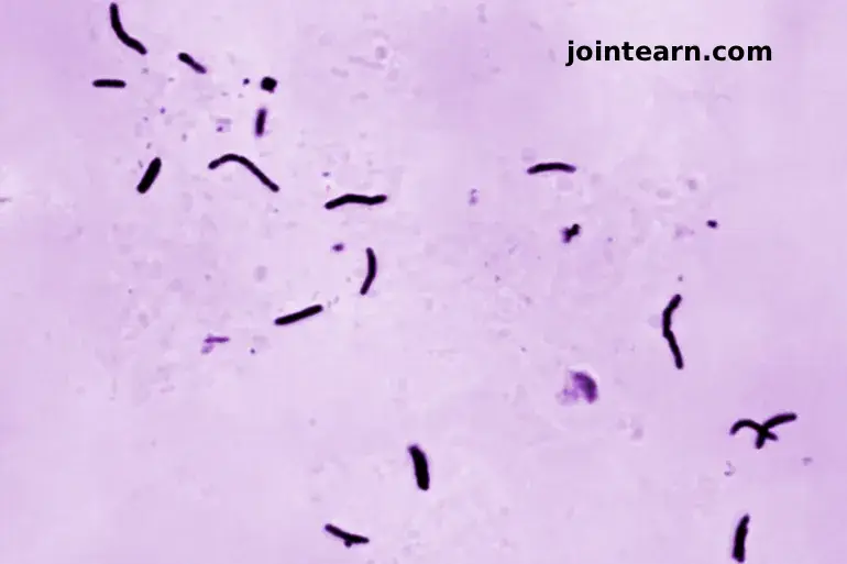 Tuberculosis Claims 1.23 Million Lives in 2024, WHO Warns of Threat to Global Progress